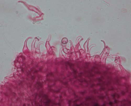 Unguiculariopsis ilincincola